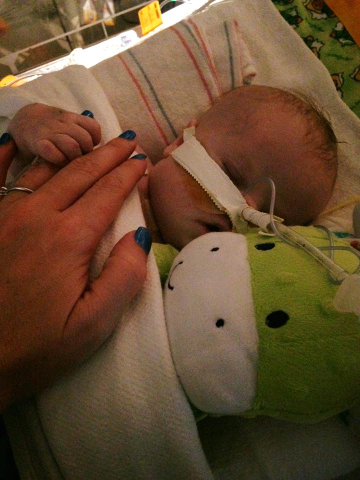 A little step backwards with the breathing tube