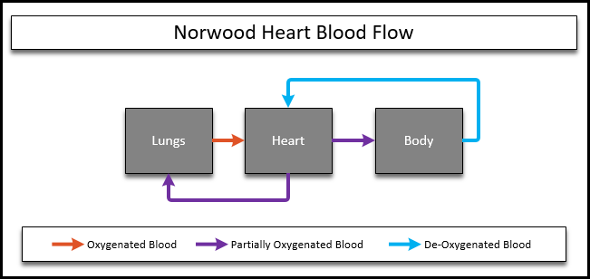 HLHS Circulation of a norwood heart. Blood from the body and the lungs combine in the heart, and partially oxygenated blood is delivered to the body.