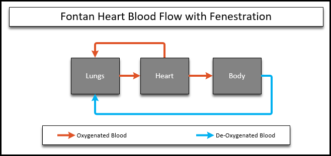 HLHS Circulation of a fenestrated fontan heart. Blood from the body bypasses the heart and returns straight to the lungs.  Circulation delivers blood from the lungs to the heart and then the body, which returns the blood directly to the lungs.  A small path is left open from the heart to the lungs to manage pressures