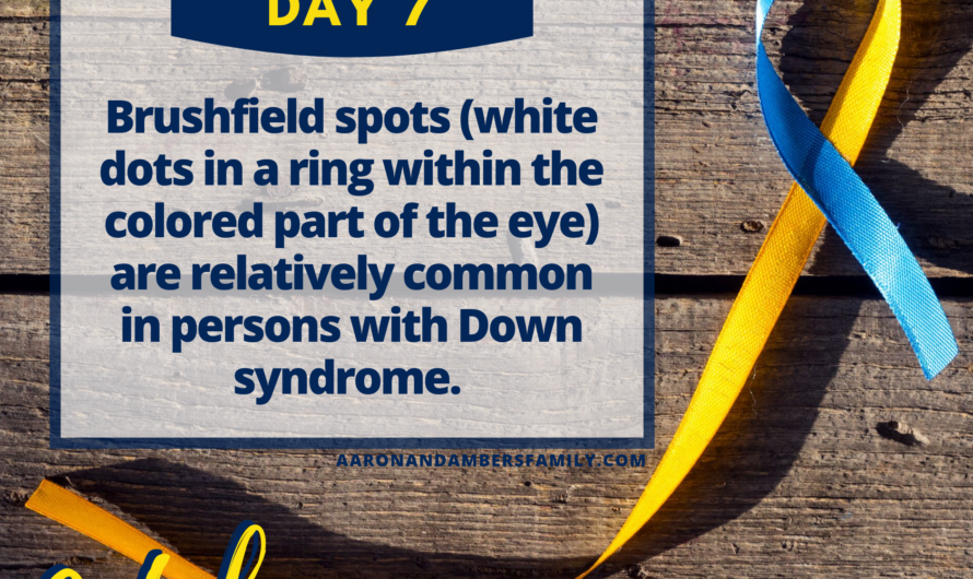 Brushfield Spots – Down Syndrome Awareness Month – Day 7.